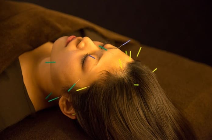 美容鍼灸